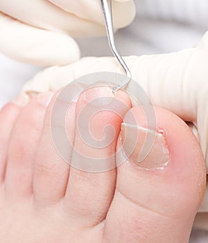 Chiropody