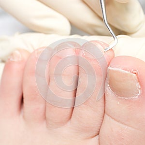 Chiropody photo