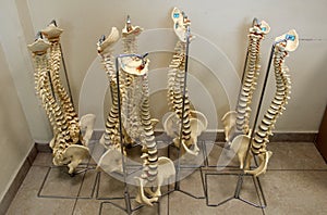 Chiropractic test plastic vertebral columns photo