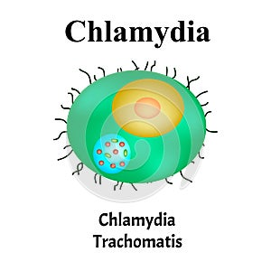 Chlamydia trachomatis. Bacterial infections Chlamydiosis. Sexually transmitted diseases. Infographics. Vector