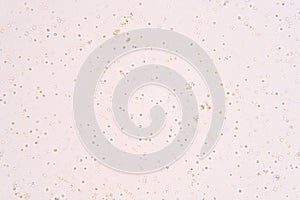 Chlorella is a genus of single-celled green algae