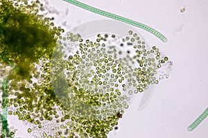 Chlorella under the microscope in Lab.