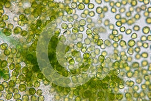 Chlorella under the microscope in Lab.
