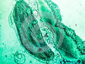 Chloroplast in a plant cell