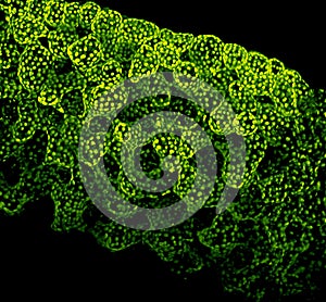 Chloroplasts photo