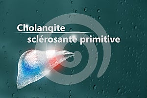 Cholangite sclÃÂ©rosante primitive, liste de contrÃÂ´le pour les patients. Fond texturÃÂ© avec copie vide pour le texte photo