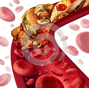 Cholesterol Blocked Artery photo