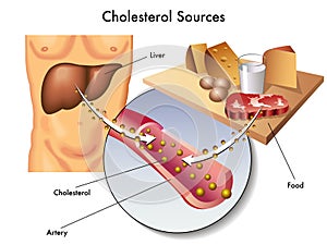 Cholesterol