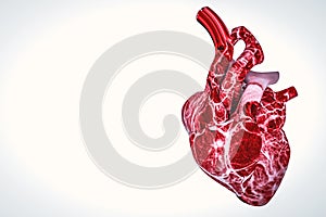 Cholesterol plaque in artery, Blood vessel with flowing blood cells