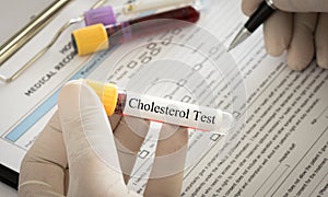 Cholesterol test