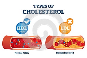 Cholesterol types comparison with HDL and LDL lipoprotein vector illustration