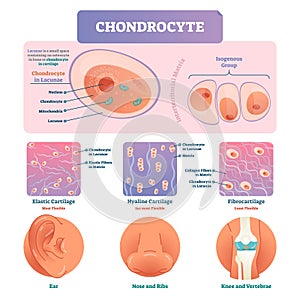 Chondrocyte vector illustration infographic. Medical labeled biology diagram