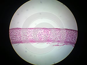 Chondrocytes photo