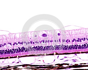 Choroid and retina