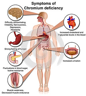 Chromium deficiency infographic, 3d medical vector illustration isolated on white background photo