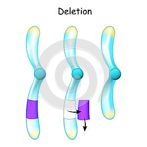Chromosome Deletion. Genetic mutation photo