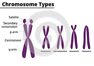 Chromosome parts and types didatic illustration. photo