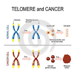 Chromosome and telomere for healthy and cancerous cells