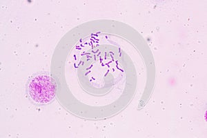Chromosomes Human under the microscope.