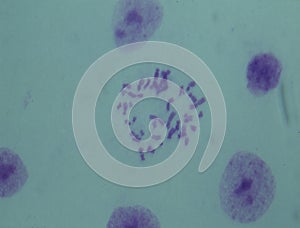 Chromosomes in the nucleus