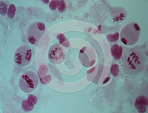 Chromosomes in the nucleus