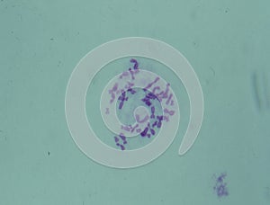 Chromosomes in the nucleus