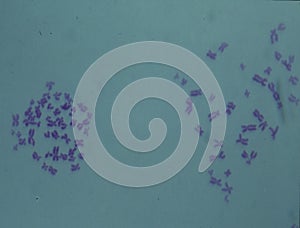 Chromosomes in the nucleus