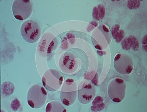 Chromosomes in the nucleus