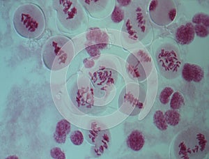 Chromosomes in the nucleus
