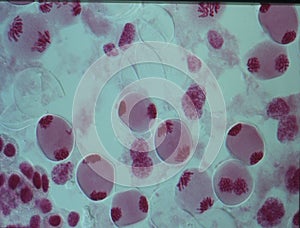 Chromosomes in the nucleus