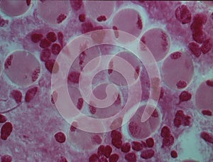 Chromosomes in the nucleus