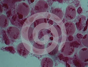 Chromosomes in the nucleus