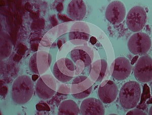 Chromosomes in the nucleus
