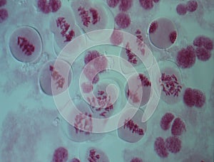 Chromosomes in the nucleus