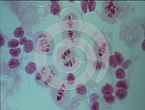 Chromosomes in the nucleus