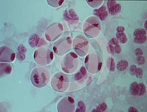 Chromosomes in the nucleus