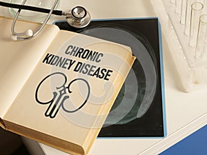 Chronic kidney disease CKD is shown using the text