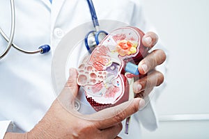 Chronic kidney disease, doctor with model for treatment urinary system, urology, Estimated glomerular filtration rate eGFR