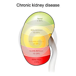 Chronic kidney disease. Stage of disorder photo