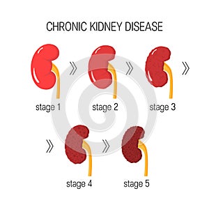 Chronic kidney disease vector