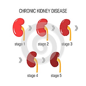 Chronic kidney disease vector photo