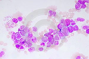 Chronic myeloid leukemia cells