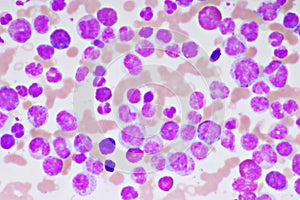 Chronic myeloid leukemia cells or CML