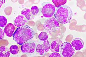 Chronic myeloid leukemia cells or CML