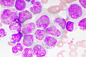 Chronic myeloid leukemia cells or CML