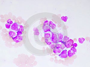 Chronic myeloid leukemia cells or CML