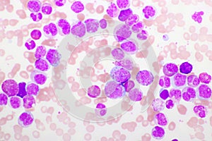 Chronic myeloid leukemia cells