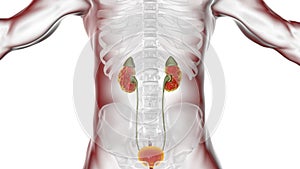 Chronic pyelonephritis, illustration