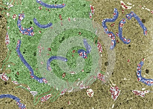 Chylomicrons. Intestinal cells