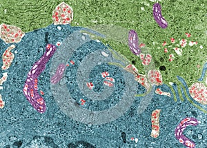 Chylomicrons. Intestinal cells
